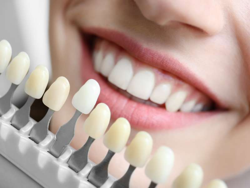 tratamientos dentales en Terrassa