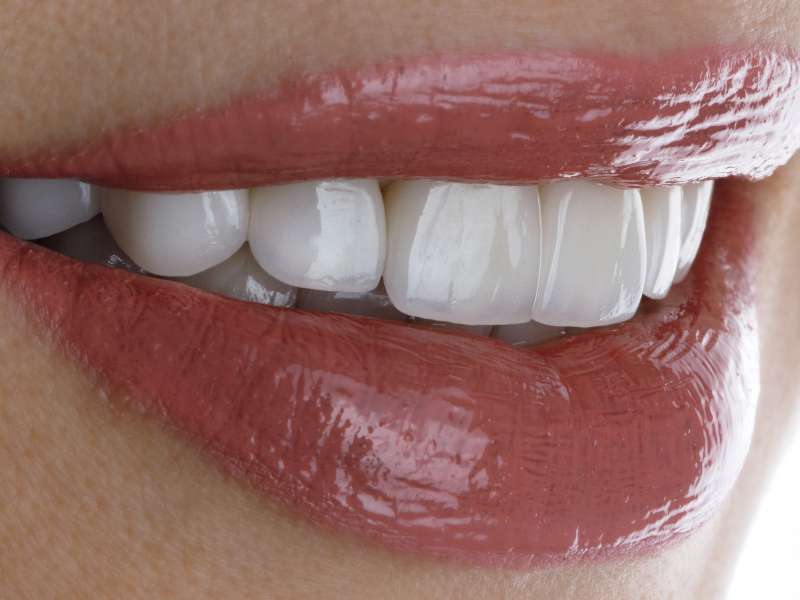 tratamientos dentales en Terrassa