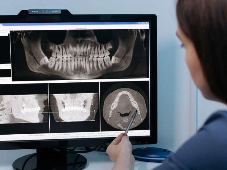 clínica dental de confianza en Terrassa