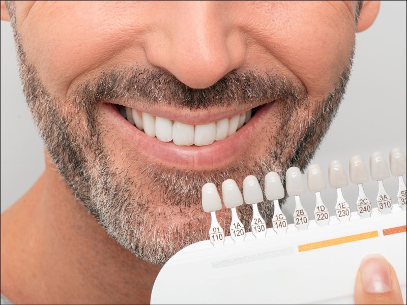 Blanqueamiento dental en Terrassa domiciliario