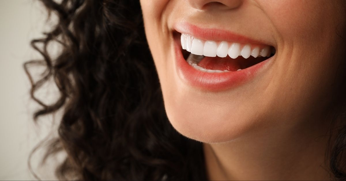 Mujer sonriendo tras tratamiento con carillas dentales en Terrassa