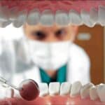 Revisión dental después del verano