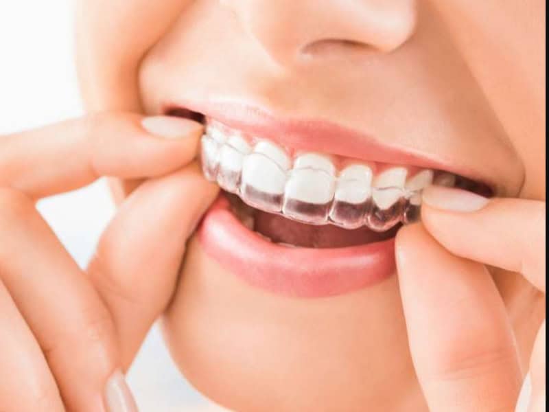 ortodoncia-dental-terrassa-1