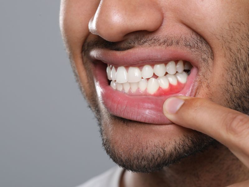 Encías inflamadas causa de por qué se mueven los dientes en adultos