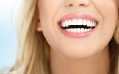 Mujer con sonrisa perfecta Ejemplo de como tener una sonrisa perfecta