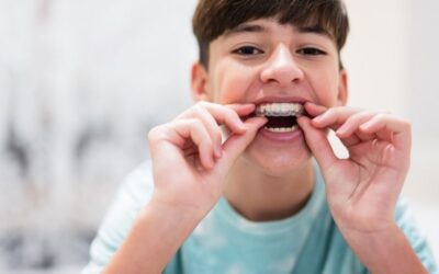 Niño con ortodoncia invisible Ortodoncia invisible en niños y adolescentes