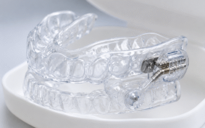 Férulas para la roncopatía y apnea del sueño personalizadas